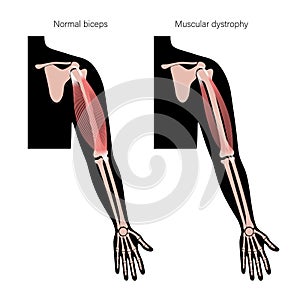 Human arm muscles