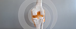 Human artificial knee joint model in medical office