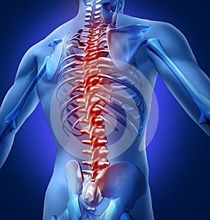 Human-Back-Pain