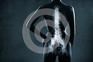 Human backbone in x-ray