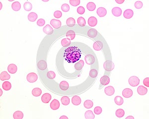 Human blood smear. Basophil