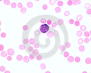 Human blood smear. Basophil