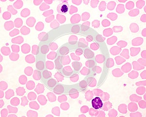Human blood smear. Lymphocyte and erythroblast photo