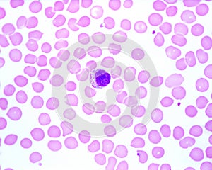 Human blood smear. Monocyte