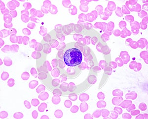 Human blood smear. Monocyte