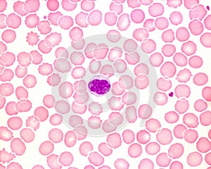 Human blood smear. Monocyte