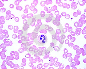 Human blood smear. Neutrophil