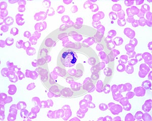 Human blood smear. Neutrophil