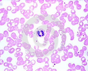 Human blood smear. Neutrophil