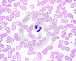 Human blood smear. Neutrophil