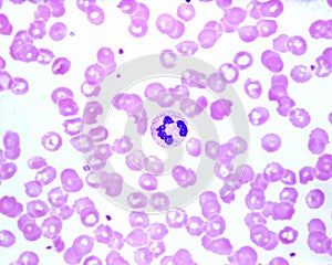 Human blood smear. Neutrophil