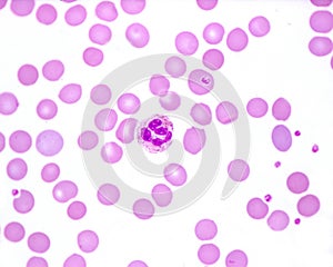 Human blood smear. Neutrophil