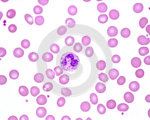 Human blood smear. Neutrophil