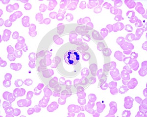 Human blood smear. Neutrophil