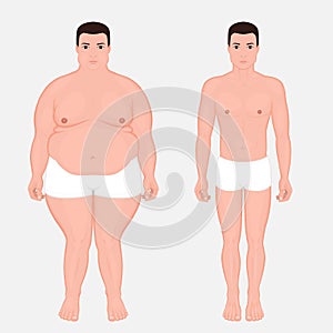 Human body anatomy_Weight loss in a European man front view