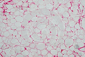 Human body fat cells photo