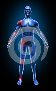 Hombre cuerpo articulación dolor inflamación médico 