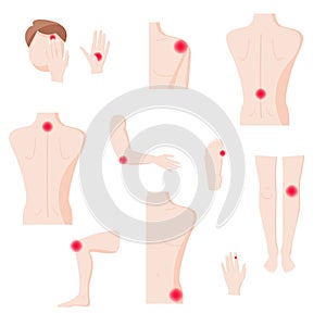 Human body parts with pain zones, vector flat isolated illustration photo