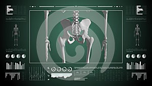 Human body skeleton study on diagnostic computer display