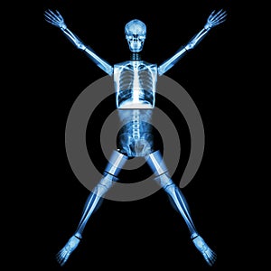 Human bone is stretching arm and leg
