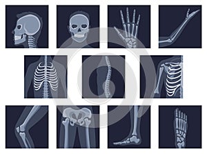 Human bones orthopedic and skeleton icon set, bone x-ray image of human joints, anatomy skeleton flat design vector