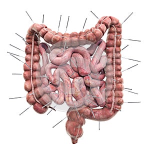 Human bowel with acupuncture needles. Acupuncture treatment of intestines concept, 3D rendering