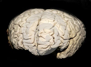 The human brain