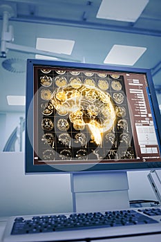 Human brain CT projection on the medical monitor