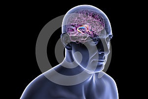 Brain fornix, 3D illustration