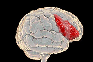 Human brain with highlighted inferior frontal gyrus photo