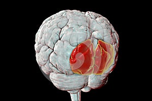 Human brain with highlighted superior occipital gyrus