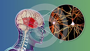 Human brain with highlighted temporal lobe and close-up view of neurons photo