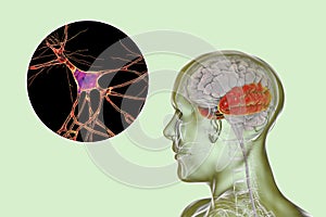 Human brain with highlighted temporal lobe and close-up view of neurons photo