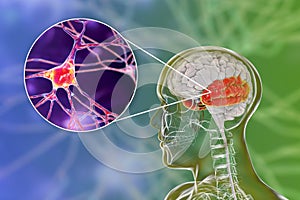 Human brain with highlighted temporal lobe and close-up view of neurons photo