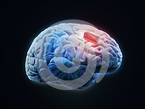 Human brain implant