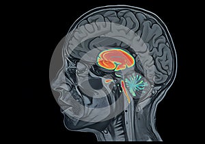 Human brain medical image profile photo