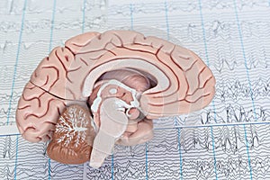 Human brain model on background of brain waves