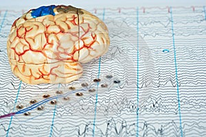 Human brain model and electrode recording brain waves on background of brain waves