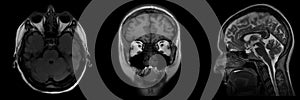 Human brain on MRI scans