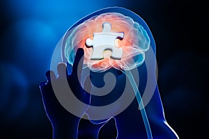 Human brain profile with jigsaw puzzle part design 3D rendering illustration. Amnesia, Alzheimer`s, memory loss or impairments,