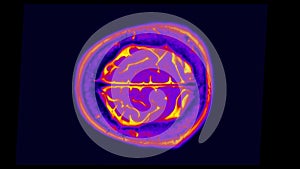 Human Brain Scan. Mri Brain Scan. Computed tomography of the human brain.