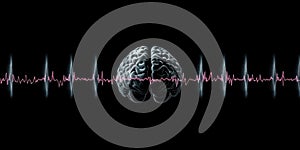 Human brain with waveform pattern on dark background