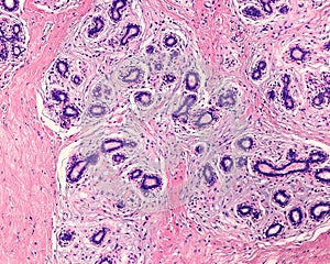 Human breast gland. Adenosis