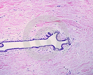 Human breast gland. Lactiferous duct