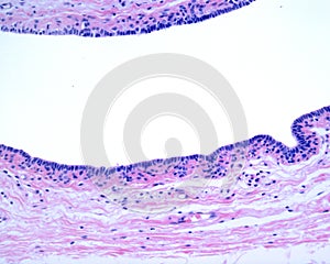 Human breast gland. Lactiferous duct