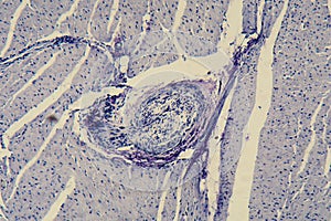Human cardiac muscle under the microscope