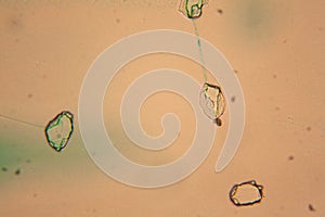 Human cells and dried water at the microscope