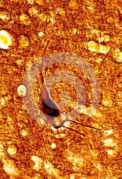 Human cerebral cortex. Pyramidal neuron. Lipofuscin