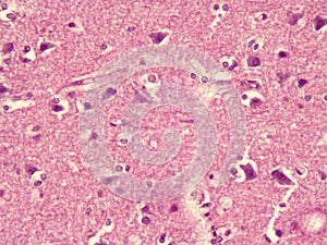 Micrograph of human cerebrum 400x magnification photo