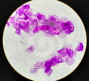 Human Cheek Epithelial Cells.